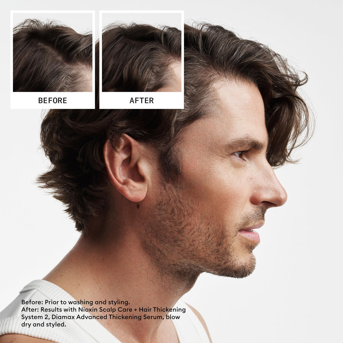 Nioxin System 2 Scalp & Hair Thickening Kit - Shampoo, Conditioner, Treatment - Natural Hair, Progressed Thinning 150+150+40ml - Damaged Box