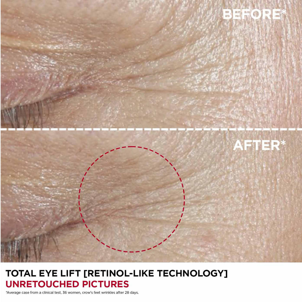 Clarins Total Eye Lift 15ml - Eye Cream Serum Treatment - New