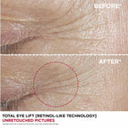 Clarins Total Eye Lift 15ml - Eye Cream Serum Treatment - New
