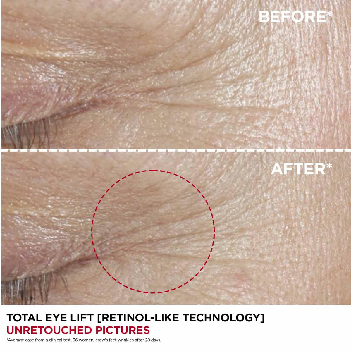 Clarins Total Eye Lift 15ml - Eye Cream Serum Treatment - New