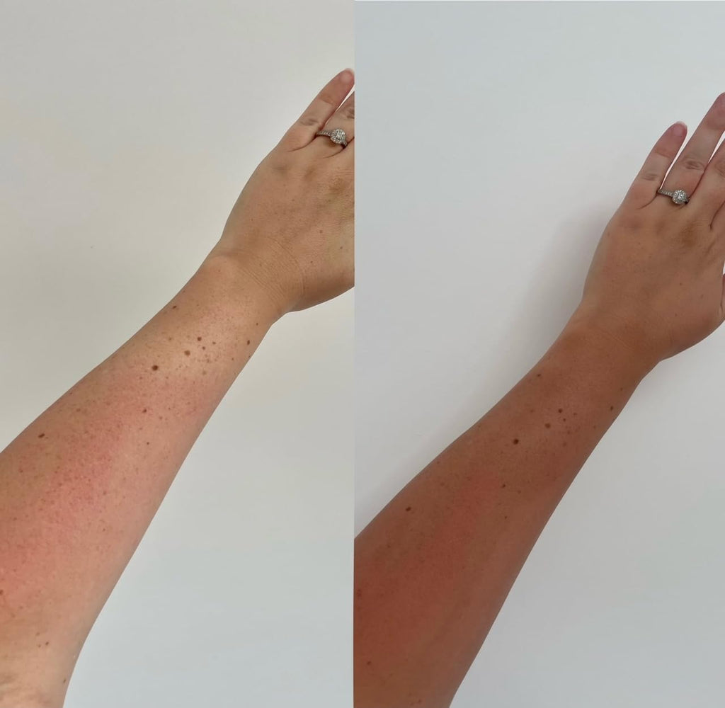 Skinny Tan Express Mousse - 1 Hour Fake Tan - Hydrating Coconut Water - Streak Free Self Tan - Vegan - 150ml - Damaged Box