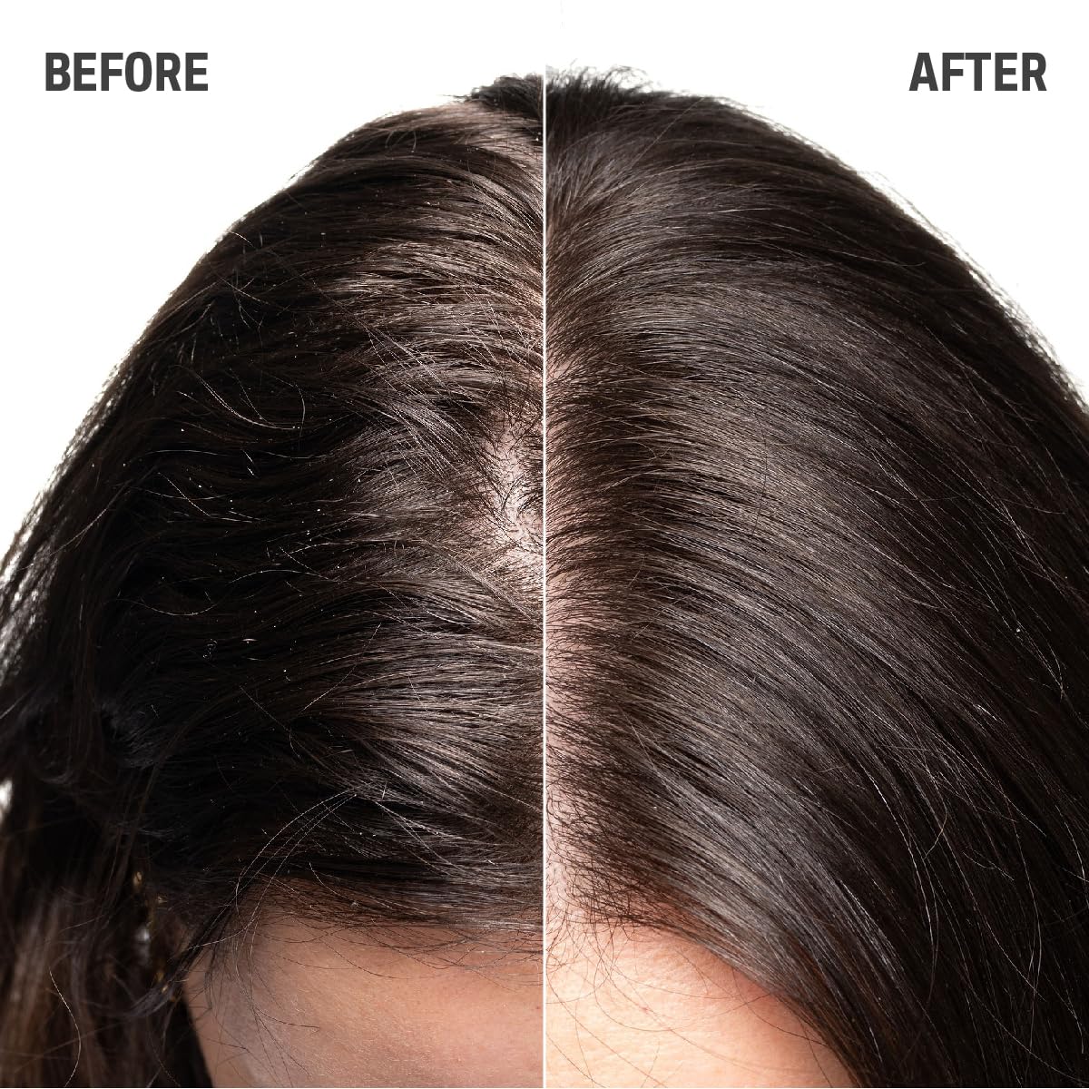 Goldwell Dualsenses Scalp Specialist Deep Cleansing Shampoo - Oily Scalp Residue Pollutant Removal 250ml - Damaged Box