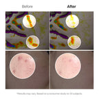 MEDITHERAPY Retinal Skin Booster Serum 150ml - Retinaldehyde Niacinamide Cica - Face Body Anti-Aging Korean Skincare - Damaged Box