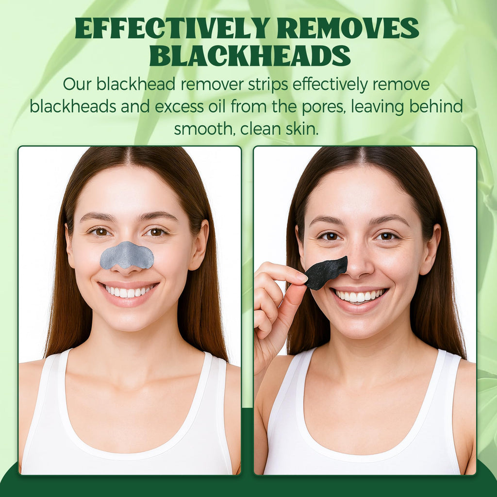 HuakChai Blackhead Remover Strips - 24 PCS Charcoal Nose Pore Strips - Deep Cleansing Face Skincare for Men & Women - New