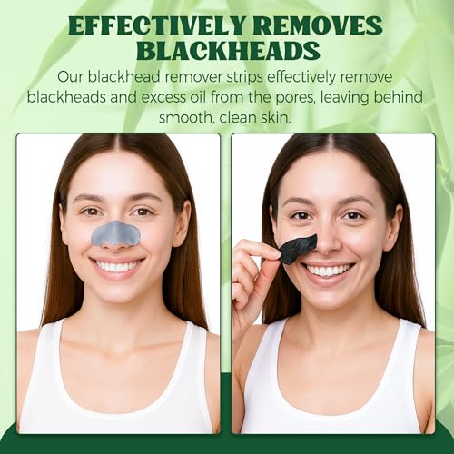 HuakChai Blackhead Remover Strips - 24 PCS Charcoal Nose Pore Strips - Deep Cleansing Face Skincare for Men & Women - New