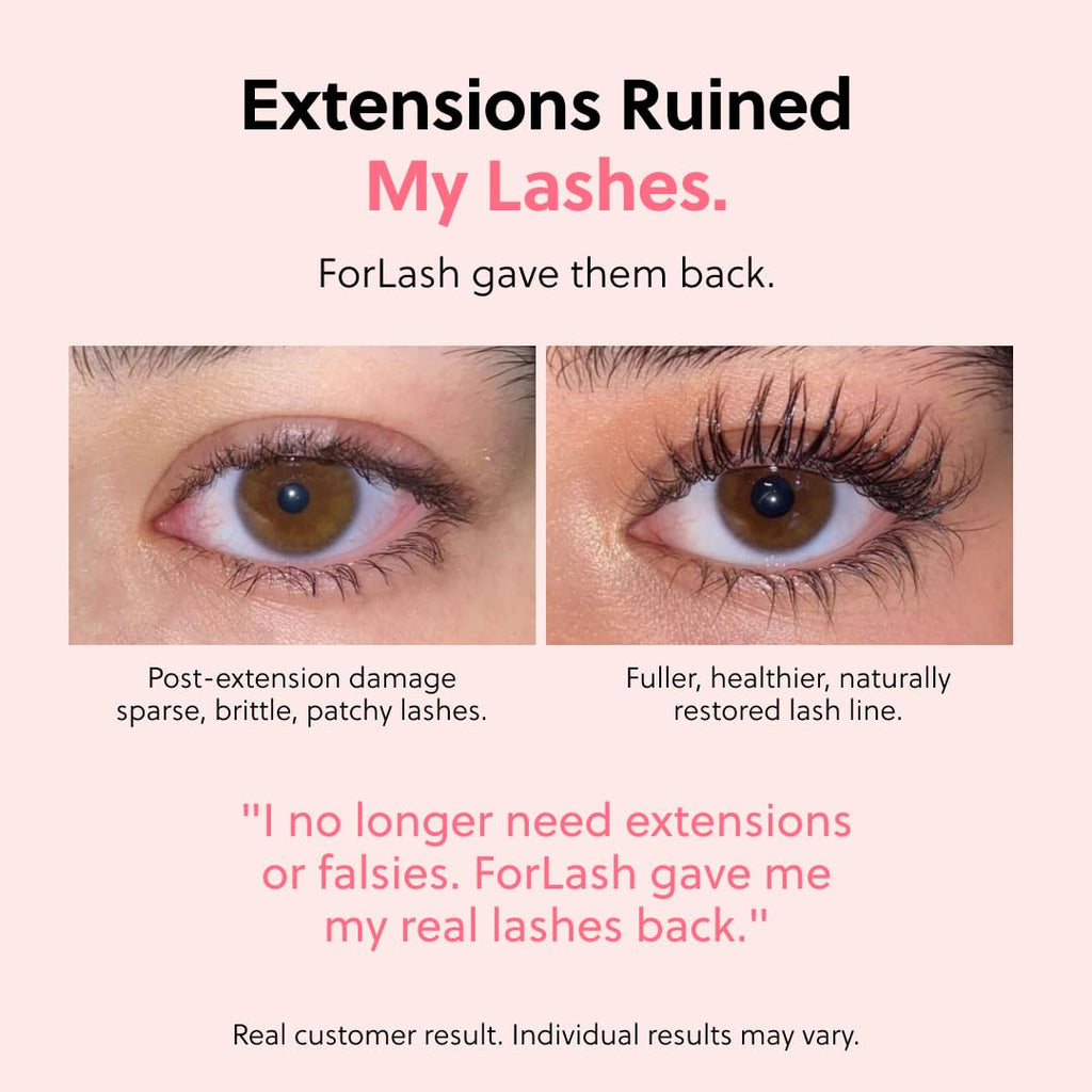 ForChics Eyelash Growth Serum - Lash & Brow Enhancer - Prostaglandin-Free Vegan Hormone-Free 3ml - New