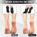 Scettar Moisturizing Spa Socks - 7 Pairs Cotton Overnight for Dry Cracked Feet - Thin Moisture Enhancing Black Foot Socks - New