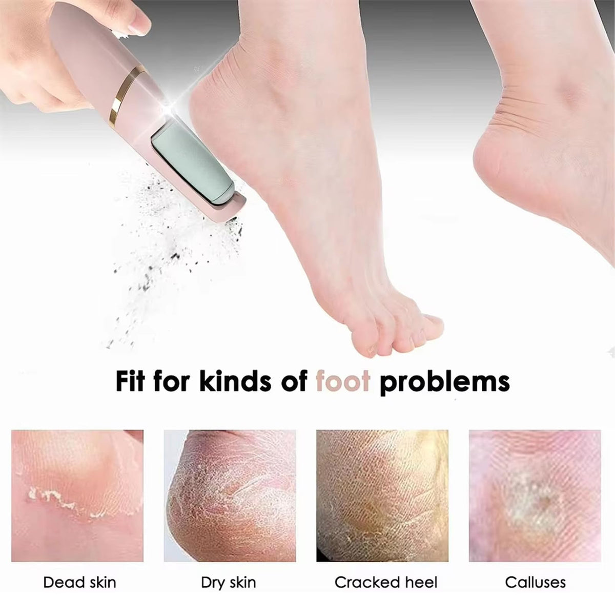 Electric Foot File Callus Remover - USB Rechargeable Waterproof Pink Pedicure Tool for Cracked Heels - 2 Heads - Damaged Box