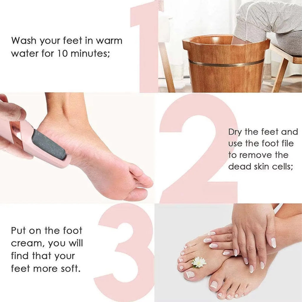 Electric Foot File Callus Remover - USB Rechargeable Waterproof Pink Pedicure Tool for Cracked Heels - 2 Heads - Damaged Box