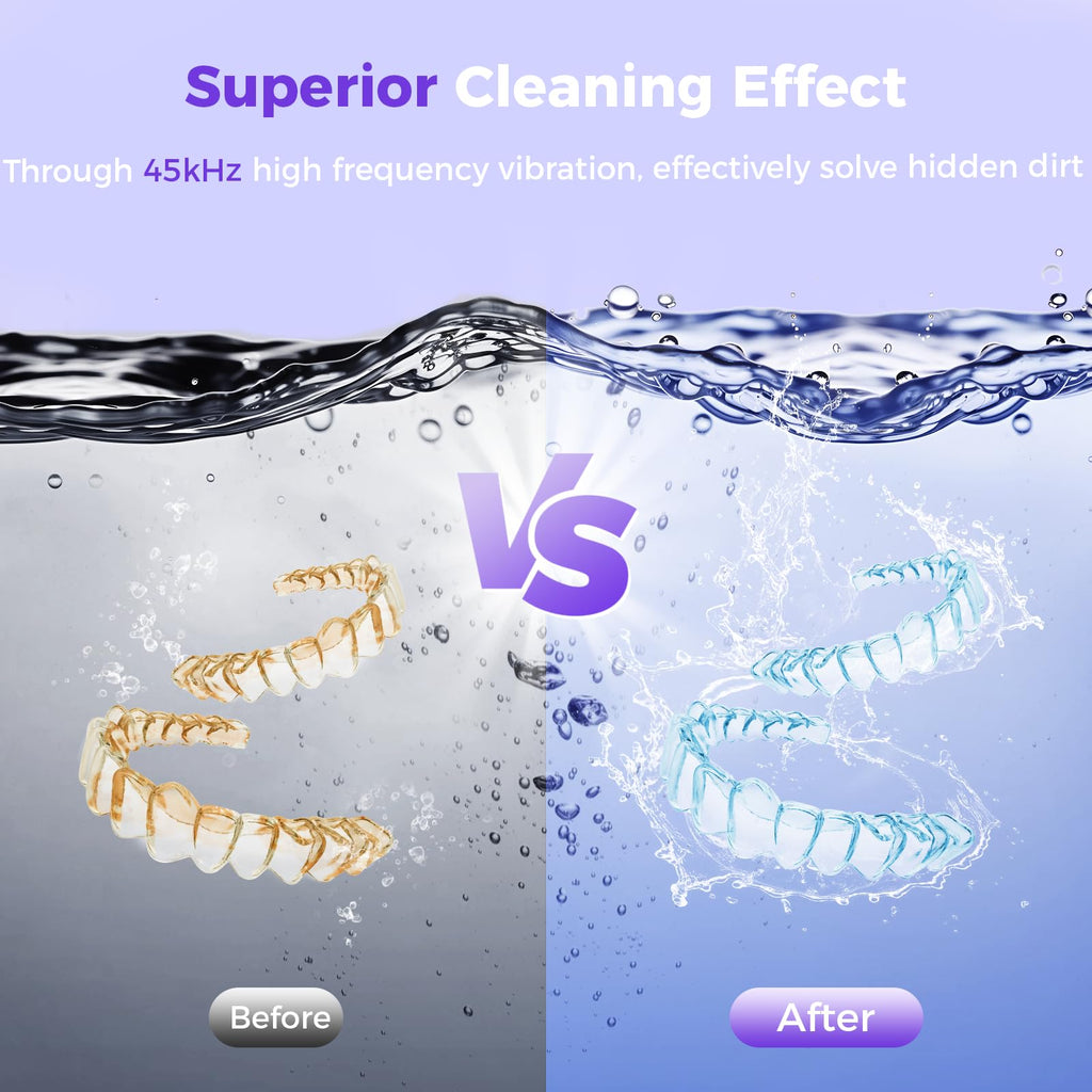 Ultrasonic Retainer Cleaner Machine 45kHz Portable Dental Cleaning Pod for Mouth Guards Aligner Night Guard Braces Jewelry - Damaged Box