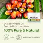 Dr. Sebi Honduras Batana Oil for Hair Growth - Natural Raw Pure Unrefined Organic - Men Women - Prevent Split Ends, Promote Thickness - Damaged Box - BBE 06/2027