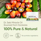 Dr. Sebi Honduras Batana Oil for Hair Growth - Natural Raw Pure Unrefined Organic - Men Women - Prevent Split Ends, Promote Thickness - Damaged Box - BBE 06/2027