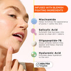 ZitSticka Killa Kit Microdart Pimple Patch For Face - Fast-Acting Acne Spot Treatment - 4 Count - Damaged Box - BBE 02/2028