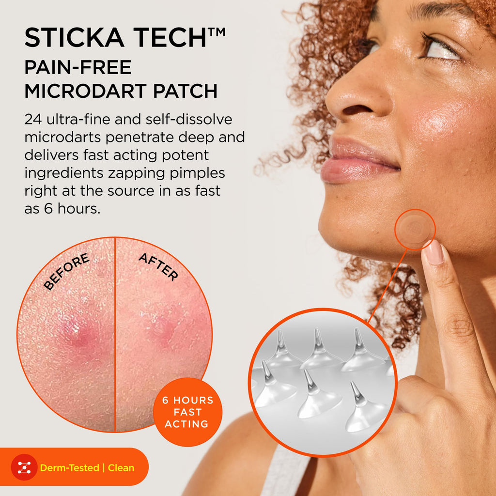 ZitSticka Killa Kit Microdart Pimple Patch For Face - Fast-Acting Acne Spot Treatment - 4 Count - Damaged Box - BBE 02/2028