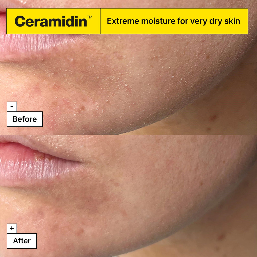 Dr.Jart+ Ceramidin Ectoin-Infused Face Cream - Dry Skin Moisturiser - Korean Skincare 50ml - Damaged Box - BBE 03/2029