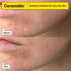 Dr.Jart+ Ceramidin Ectoin-Infused Face Cream - Dry Skin Moisturiser - Korean Skincare 50ml - Damaged Box - BBE 03/2029