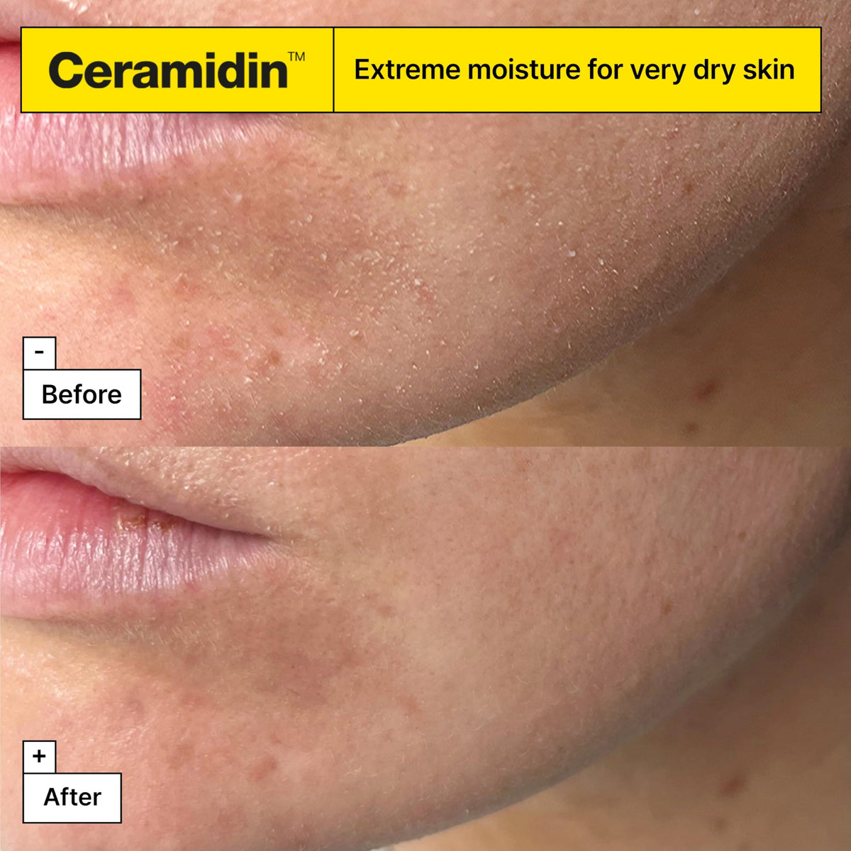 Dr.Jart+ Ceramidin Ectoin-Infused Face Cream - Dry Skin Moisturiser - Korean Skincare 50ml - Damaged Box - BBE 03/2029