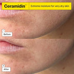 Dr.Jart+ Ceramidin Ectoin-Infused Face Cream - Dry Skin Moisturiser - Korean Skincare 50ml - Damaged Box - BBE 03/2029